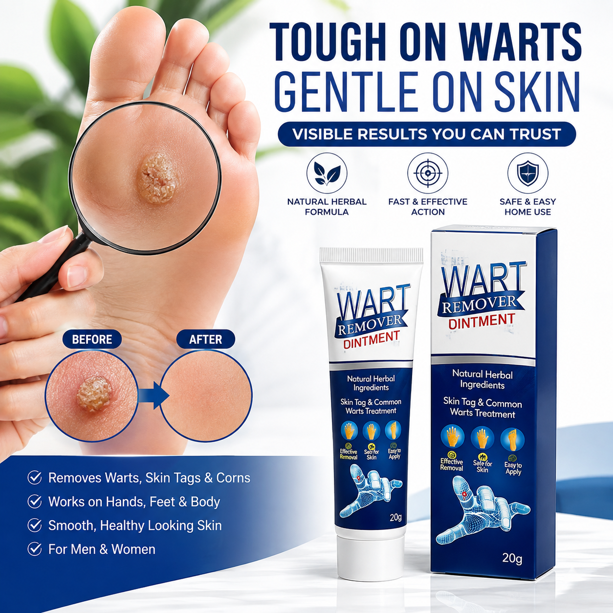 Wart Removal Ointment Cream – Fast Acting Skin Tag & Common Wart Remover for Clear, Smooth Skin