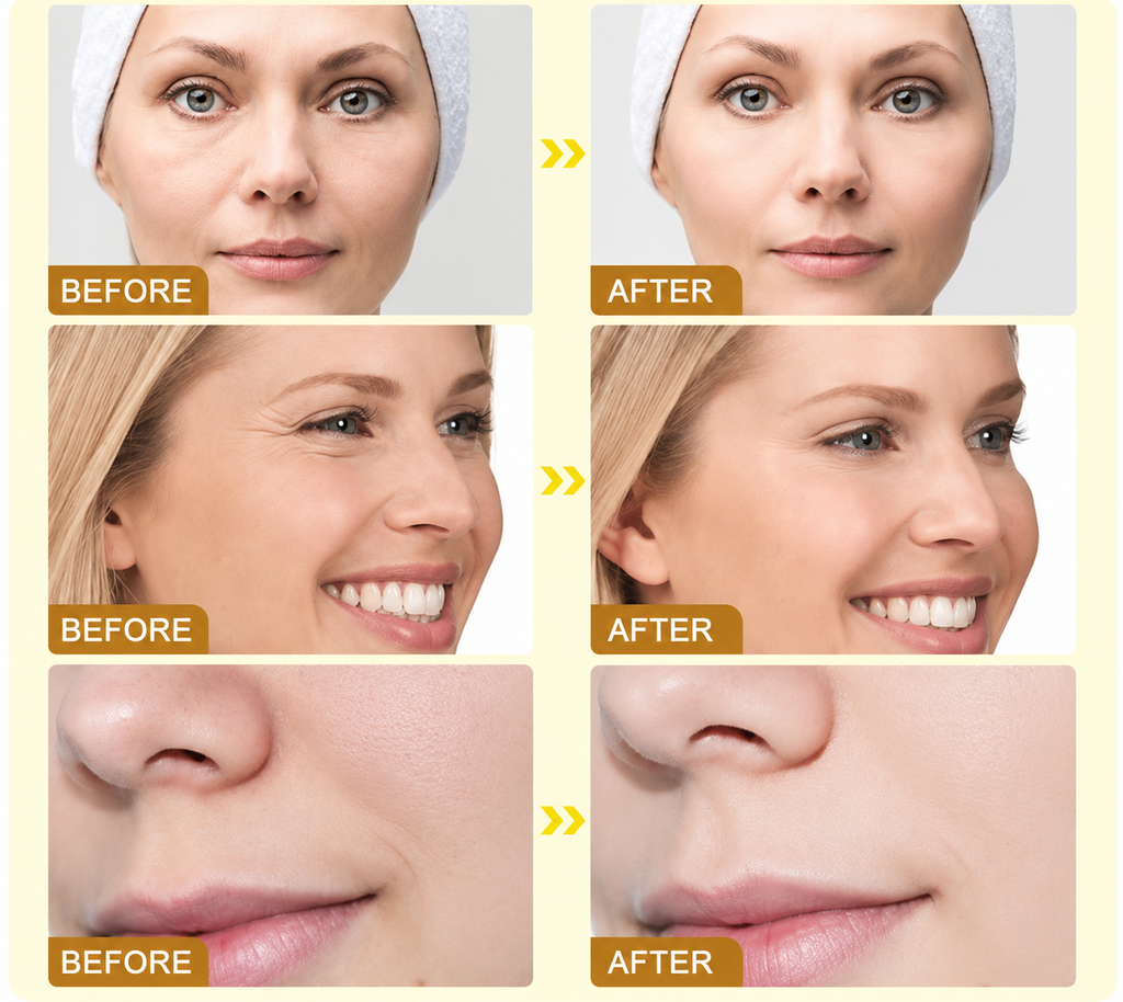 BOTOX Bee Venom Youth Renewal Eye Cream – Firming, Hydrating & Smoothing Formula