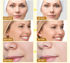 BOTOX Bee Venom Youth Renewal Eye Cream – Firming, Hydrating & Smoothing Formula