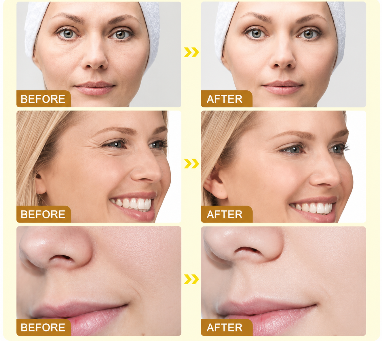 BOTOX Bee Venom Youth Renewal Eye Cream – Firming, Hydrating & Smoothing Formula
