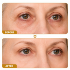 BOTOX Bee Venom Youth Renewal Eye Cream – Firming, Hydrating & Smoothing Formula