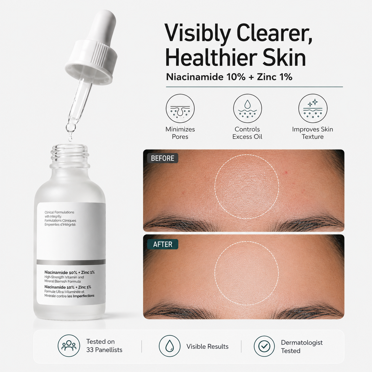 Original Ordinary Niacinamide 10% + Zinc 1% – Pore & Blemish Control Serum – Free Shipping