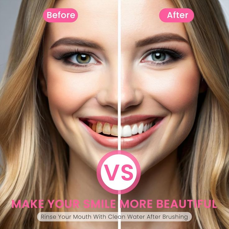 Niacinamide BrightSmile Toothpaste – Whitening, Stain Removal & Fresh Breath