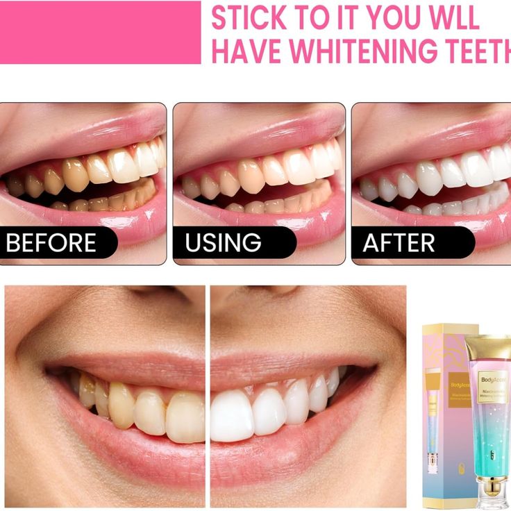 Niacinamide BrightSmile Toothpaste – Whitening, Stain Removal & Fresh Breath
