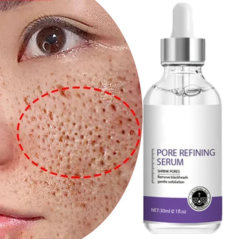Retinol + Niacinamide Facial Serum (30ml)