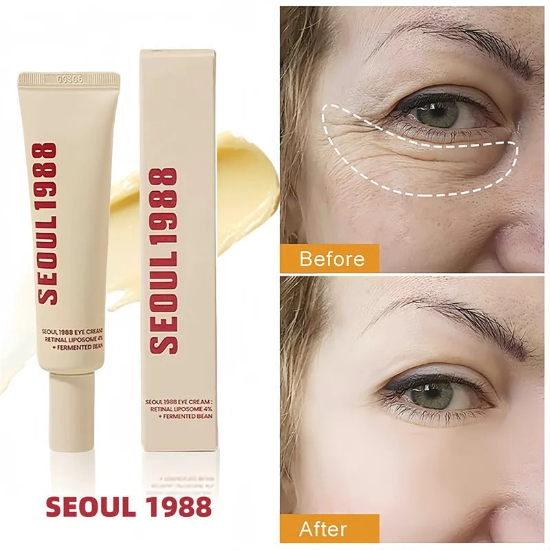 Seoul 1988 Retinol Eye Cream for Dark Circles, Wrinkles & Firming
