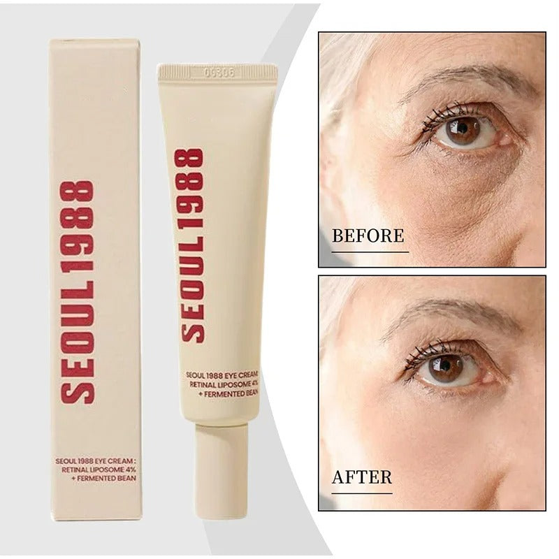 Seoul 1988 Retinol Eye Cream for Dark Circles, Wrinkles & Firming