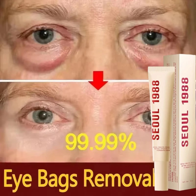 Seoul 1988 Retinol Eye Cream for Dark Circles, Wrinkles & Firming