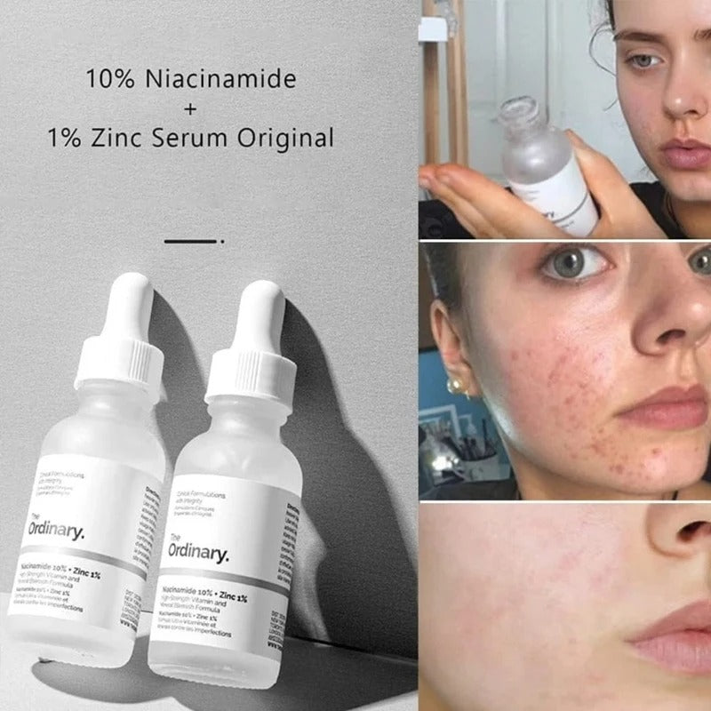 Original Ordinary Niacinamide 10% + Zinc 1% – Pore & Blemish Control Serum – Free Shipping
