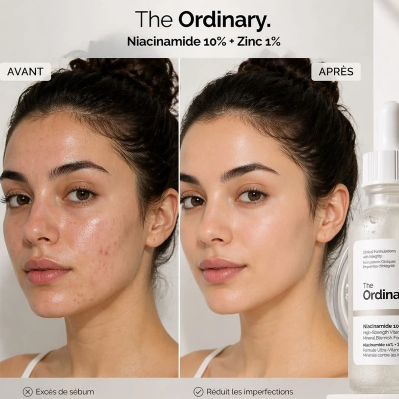 Original Ordinary Niacinamide 10% + Zinc 1% – Pore & Blemish Control Serum – Free Shipping