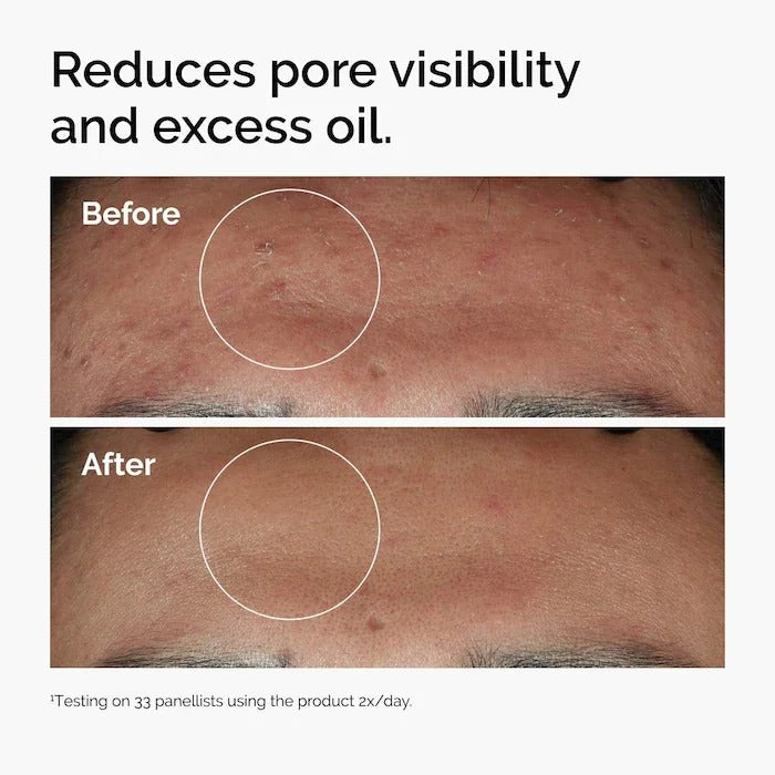 Niacinamide 10% + Zinc 1% Serum (30ml)