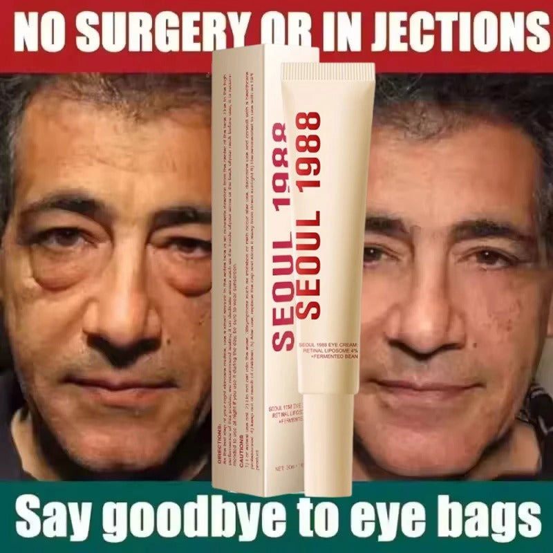 Seoul 1988 Retinol Eye Cream for Dark Circles, Wrinkles & Firming