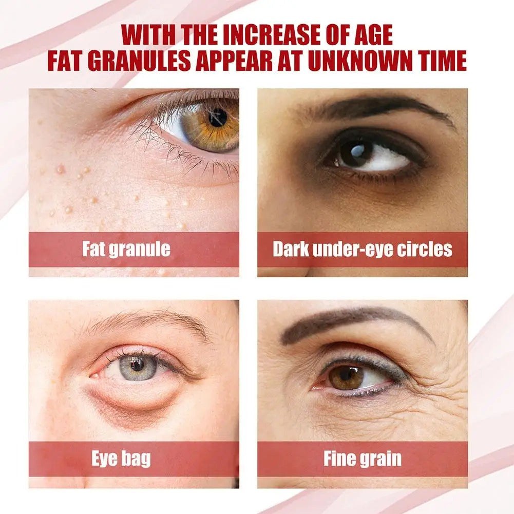 Eye Renewal Serum (30ml)