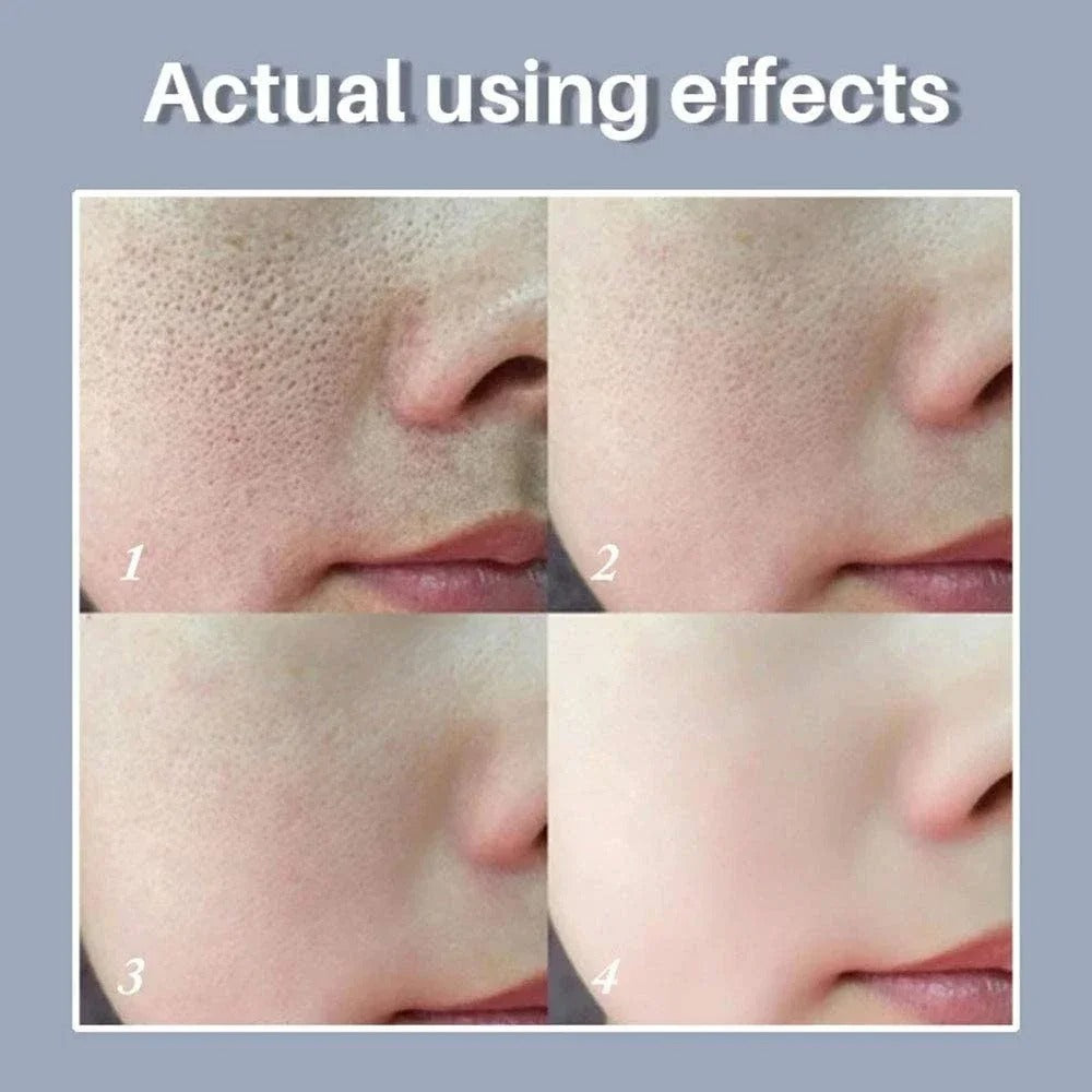 Retinol + Niacinamide Facial Serum (30ml)