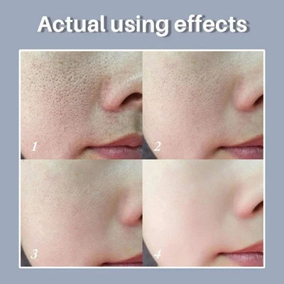 Retinol + Niacinamide Facial Serum (30ml) Review by Omar Al Shamsi