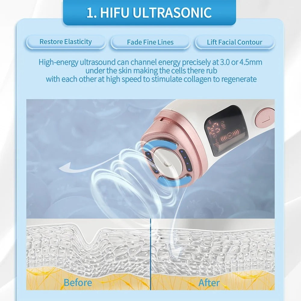 Mini HIFU RF Facial Lifting Device