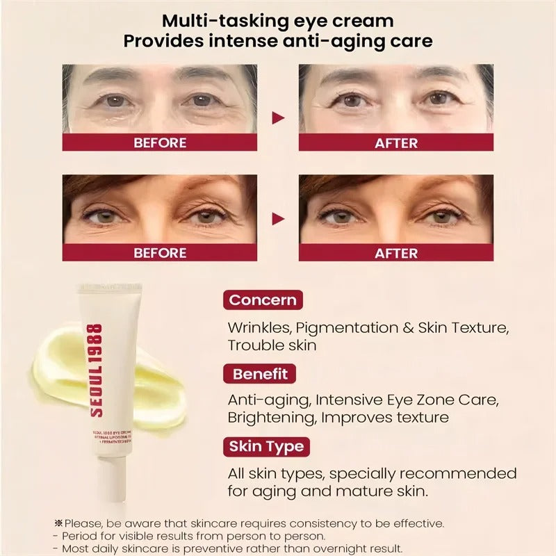 Seoul 1988 Retinol Eye Cream for Dark Circles, Wrinkles & Firming