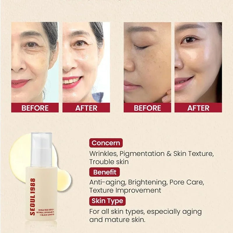 Seoul 1988 Retinol Eye Cream for Dark Circles, Wrinkles & Firming