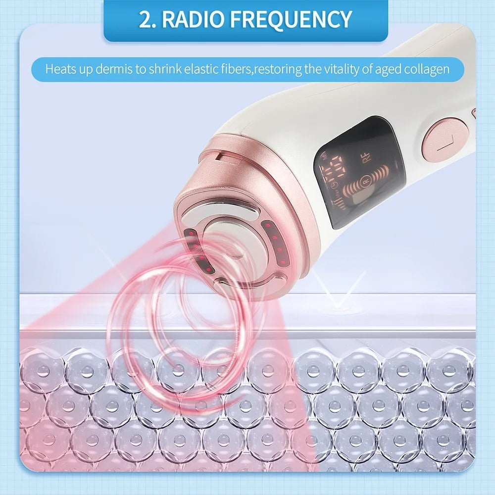 Mini HIFU RF Facial Lifting Device