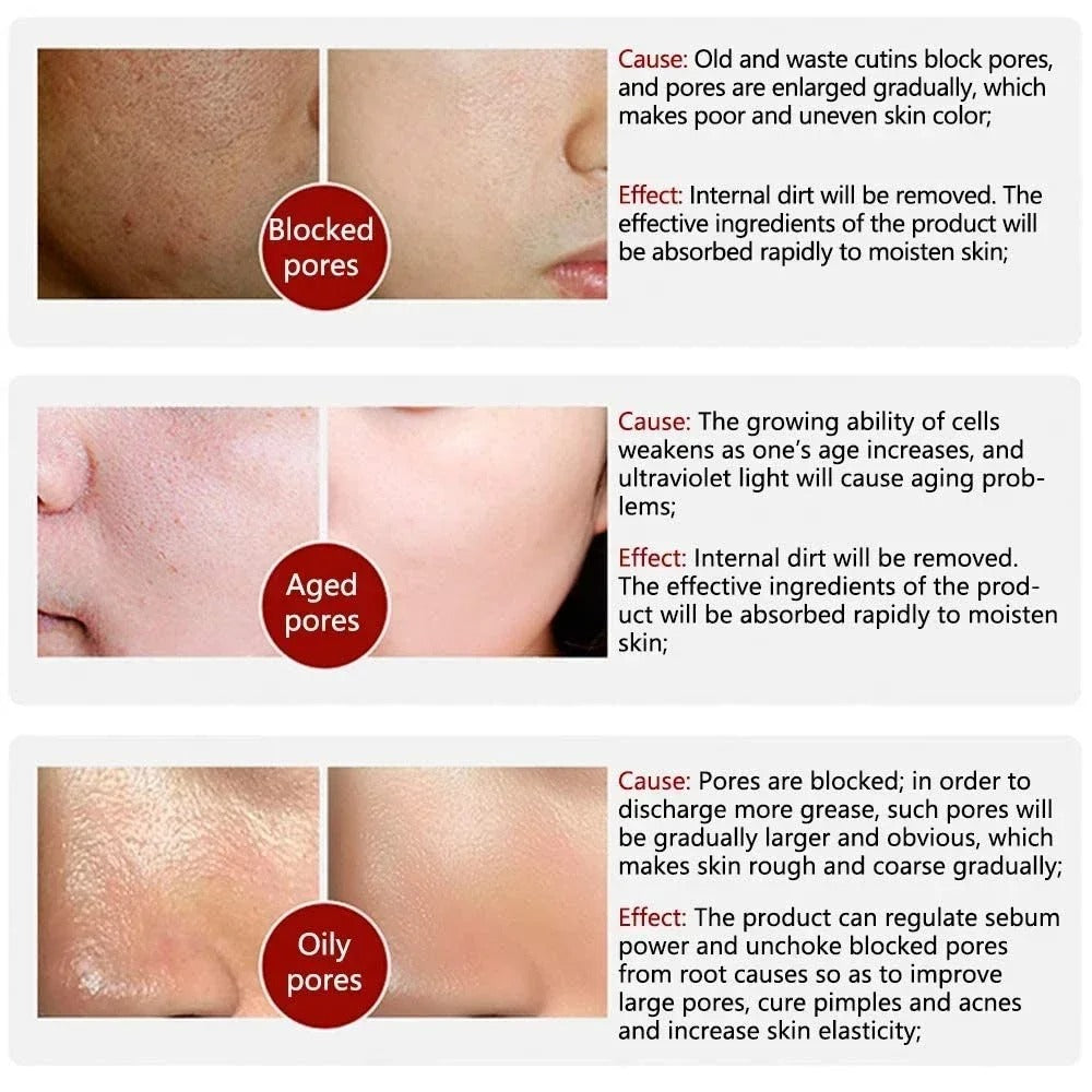 Retinol + Niacinamide Facial Serum (30ml)