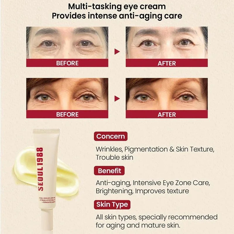 Seoul 1988 Retinol Eye Cream for Dark Circles, Wrinkles & Firming