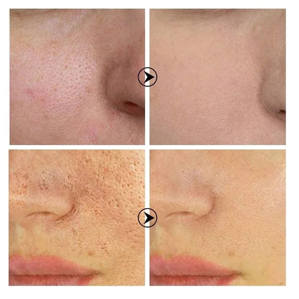 Retinol + Niacinamide Facial Serum (30ml)