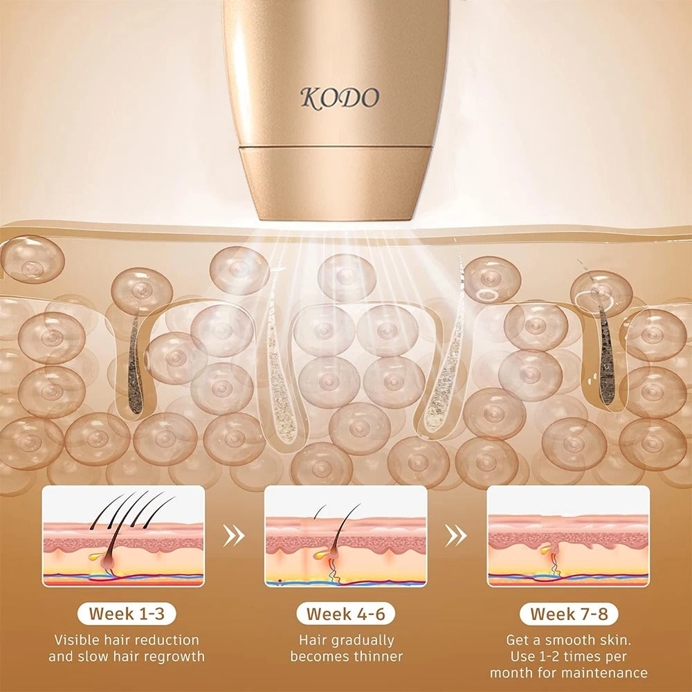 KODO IPL Hair Removal Device (4-in-1)