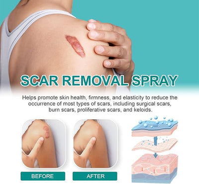 Medical Scar removal spray Review by Fatima Al Mansoori