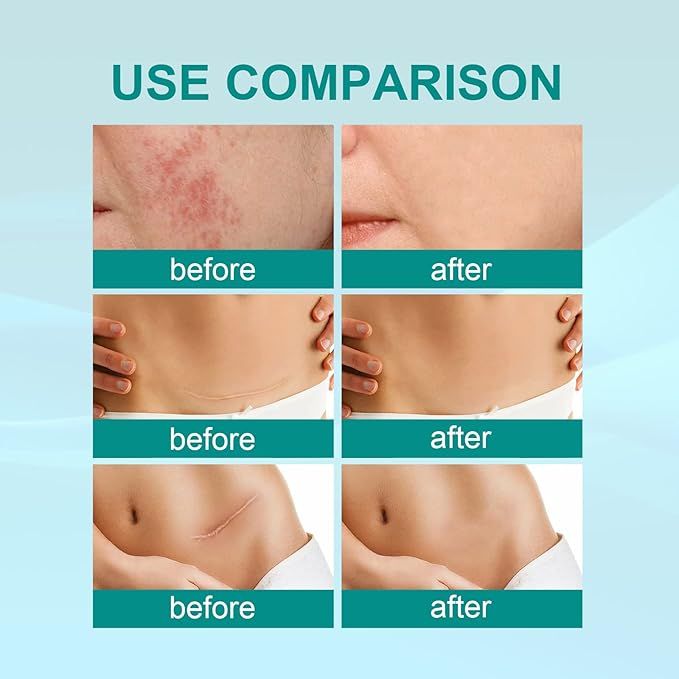 Medical Scar removal spray