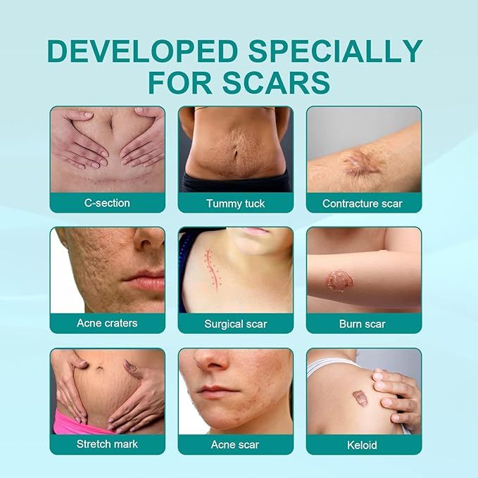 Medical Scar removal spray
