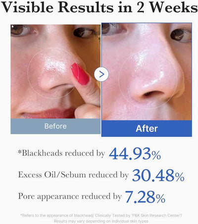 Medicube Dual-Textured Facial Toner Pads Review by Zayed Al Hashimi